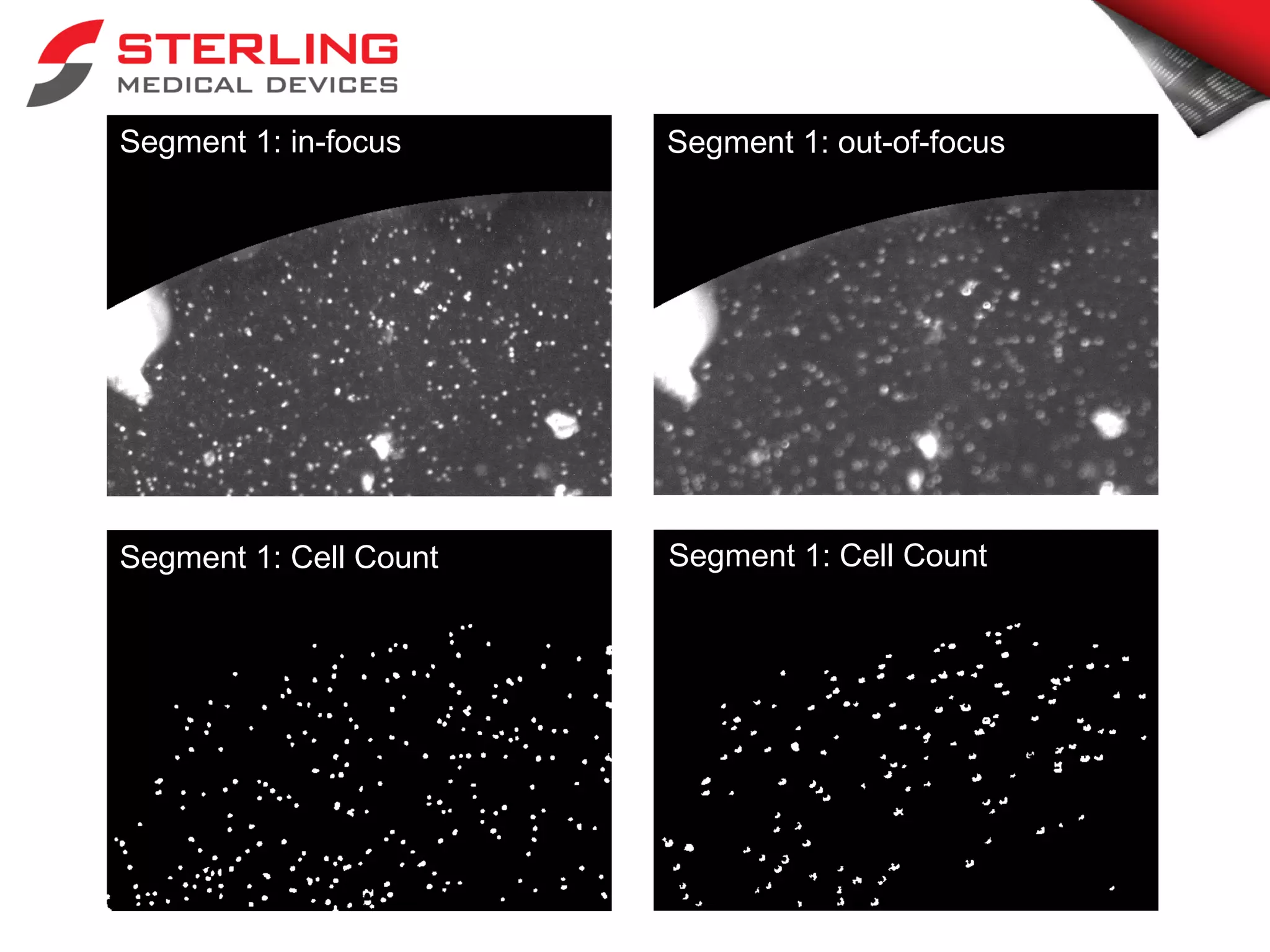 Segment 1: in-focus Segment 1: out-of-focus
Segment 1: Cell Count Segment 1: Cell Count
 