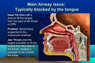 Main Airway issue:Main Airway issue:
Typically blocked by the tongueTypically blocked by the tongue
Head Tilt Chin Lift is
done to lift the tongue
from the back of the throat
in CPR.
Problem: Spinal Injury
suspected in ALL
motorcycle Crashes!
Jaw Thrust uses the
hinged mandible to lift the
tongue from the back of
the throat, creating a
passage for air to enter
the lungs
 