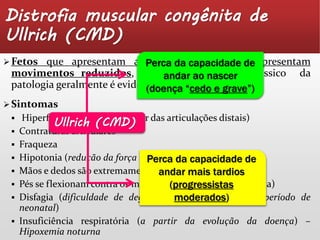 Distrofia muscular congênita de 
Ullrich (CMD) 
Fetos que apresentam a doença de Ullrich apresentam 
movimentos reduzidos, visto que o fenótipo clássico da 
patologia geralmente é evidente no nascimento. 
 Sintomas 
Perca da capacidade de 
andar ao nascer 
(doença “cedo e grave”) 
 Hiperfrouxidão (em particular das articulações distais) 
Ullrich (CMD) 
 Contraturas articulares 
 Fraqueza 
 Hipotonia (redução da força muscular) 
Perca da capacidade de 
 Mãos e dedos são extremamente flexíveis 
andar mais tardios 
 Pés se flexionam contra os membros inferiores (tíbia e fíbula) 
(progressistas 
moderados) 
 Disfagia (dificuldade de deglutição, principalmente no período de 
neonatal) 
 Insuficiência respiratória (a partir da evolução da doença) – 
Hipoxemia noturna 
 