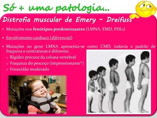 Distrofia muscular de Emery – Dreifuss 
 Mutações nos fenótipos predominantes (LMNA, EMD, FHL1) 
 Envolvimento cardíaco (diferencial) 
 Mutações no gene LMNA apresenta-se como CMD, todavia o padrão de 
fraqueza e contraturas é diferente. 
o Rigidez precoce da coluna vertebral 
o Fraqueza do pescoço (impressionante*) 
o Frouxidão moderado 
 