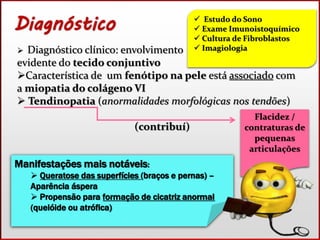  Estudo do Sono 
 Exame Imunoistoquímico 
 Cultura de Fibroblastos 
 Imagiologia 
 Diagnóstico clínico: envolvimento 
evidente do tecido conjuntivo 
Característica de um fenótipo na pele está associado com 
a miopatia do colágeno VI 
 Tendinopatia (anormalidades morfológicas nos tendões) 
(contribuí) 
Flacidez / 
contraturas de 
pequenas 
articulações 
Manifestações mais notáveis: 
 Queratose das superfícies (braços e pernas) – 
Aparência áspera 
 Propensão para formação de cicatriz anormal 
(quelóide ou atrófica) 
 