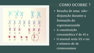 COMO OCORRE ?
• Resulta de uma não-
disjunção durante a
formação do
espermatozoide
• A constituição
crossomática é de 45 x
• O normal seria XX e ter
o número de 46
cromossomos
 