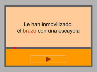 Le han inmovilizado
el brazo con una escayola

 