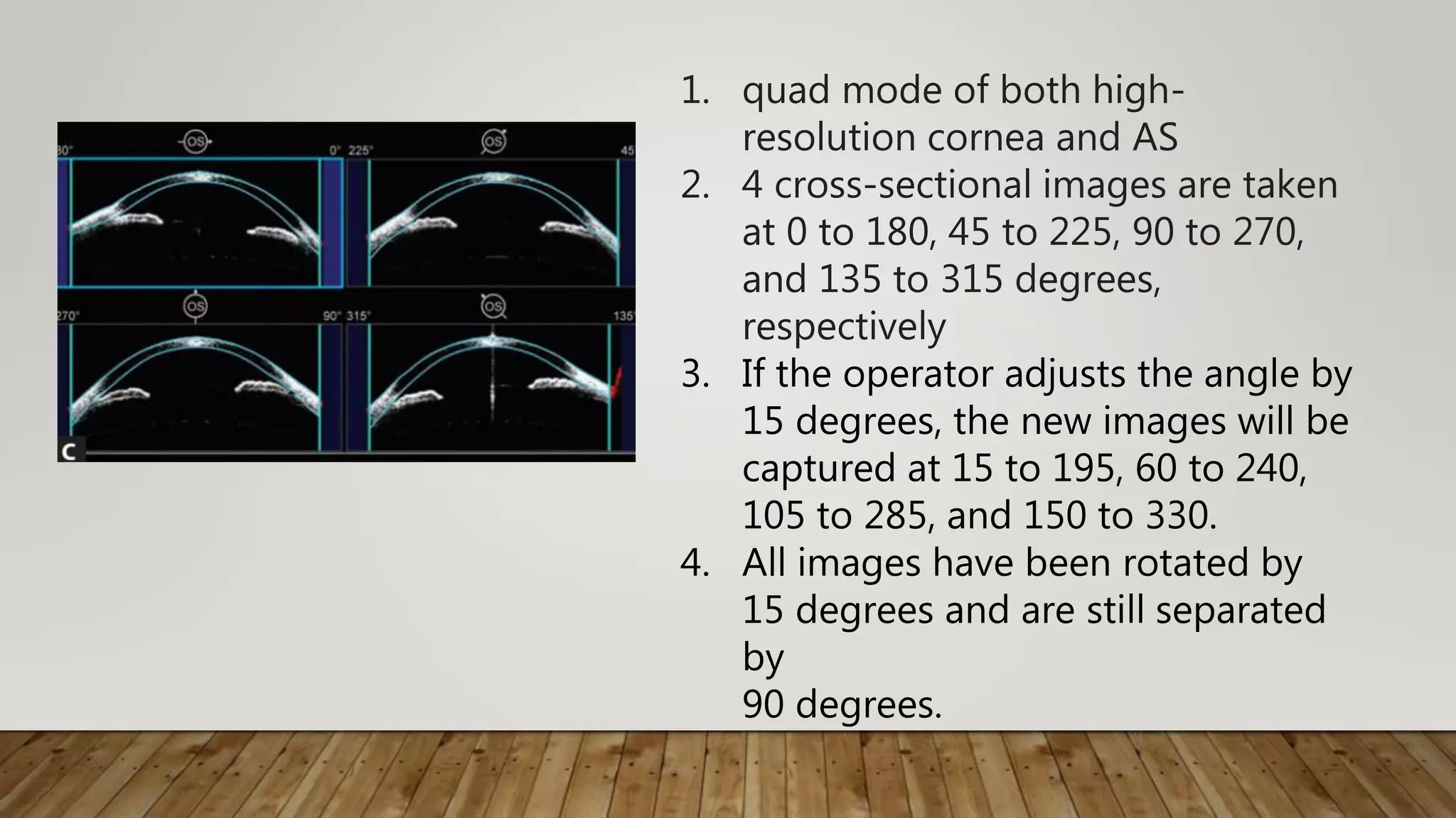 1. quad mode of both high-
resolution cornea and AS
2. 4 cross-sectional images are taken
at 0 to 180, 45 to 225, 90 to 270,
and 135 to 315 degrees,
respectively
3. If the operator adjusts the angle by
15 degrees, the new images will be
captured at 15 to 195, 60 to 240,
105 to 285, and 150 to 330.
4. All images have been rotated by
15 degrees and are still separated
by
90 degrees.
 