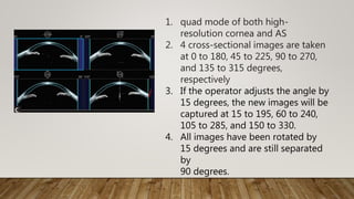 1. quad mode of both high-
resolution cornea and AS
2. 4 cross-sectional images are taken
at 0 to 180, 45 to 225, 90 to 270,
and 135 to 315 degrees,
respectively
3. If the operator adjusts the angle by
15 degrees, the new images will be
captured at 15 to 195, 60 to 240,
105 to 285, and 150 to 330.
4. All images have been rotated by
15 degrees and are still separated
by
90 degrees.
 