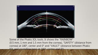 Some of the Phakic IOL tools. It shows the “RAINBOW”
(0.5 mm, 1 mm and 1.5 mm from the cornea), “SAFETY” (distance from
cornea) at 180°, center and 0° and “VAULT” (distance between Phakic
IOL and crystalline lens) at 180°, center and 0°)
 