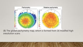 (B) The global pachymetry map, which is formed from 16 modifed high
sresolution scans
 