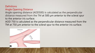 Defnitions
Angle Opening Distance
Angle opening distance (AOD500) is calculated as the perpendicular
distance measured from the TM at 500 µm anterior to the scleral spur
to the anterior iris surface.
AOD 750 is calculated as the perpendicular distance measured from the
TM at 750 µm anterior to the scleral spur to the anterior iris surface.
 