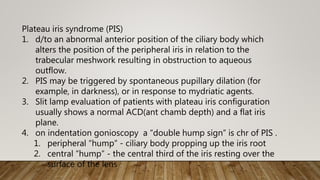 Plateau iris syndrome (PIS)
1. d/to an abnormal anterior position of the ciliary body which
alters the position of the peripheral iris in relation to the
trabecular meshwork resulting in obstruction to aqueous
outflow.
2. PIS may be triggered by spontaneous pupillary dilation (for
example, in darkness), or in response to mydriatic agents.
3. Slit lamp evaluation of patients with plateau iris configuration
usually shows a normal ACD(ant chamb depth) and a flat iris
plane.
4. on indentation gonioscopy a “double hump sign” is chr of PIS .
1. peripheral “hump” - ciliary body propping up the iris root
2. central “hump” - the central third of the iris resting over the
surface of the lens
 