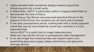 5. Highly elevated blebs sometimes display marked conjunctival
thickening and only a small cavity.
6. In failed blebs, ASOCT is particularly useful in imaging failed blebs to
demonstrate the level of failure.
7. Ostial closure, flap fibrosis and presumed episcleral fibrosis in the
absence of the former two situations are all clearly demonstrated.
8. In the early postoperative period, a failing bleb with a closely apposed
scleral flap may be resuscitated by suture lysis, resulting in a more
expanded bleb.
Hence ASOCT is a useful tool to image trabeculectomy
blebs and may aid the clinician in postoperative bleb management.
9. It can also image the intrascleral lake and implant used in non-
penetrating glaucoma surgery (deep sclerectomy) and glaucoma
drainage devices
 