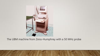 The UBM machine from Zeiss-Humphrey with a 50 MHz probe
 