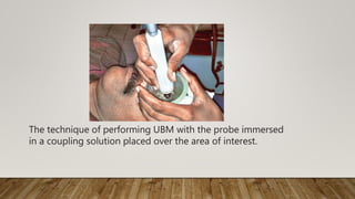 The technique of performing UBM with the probe immersed
in a coupling solution placed over the area of interest.
 