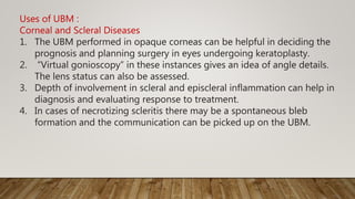 Uses of UBM :
Corneal and Scleral Diseases
1. The UBM performed in opaque corneas can be helpful in deciding the
prognosis and planning surgery in eyes undergoing keratoplasty.
2. “Virtual gonioscopy” in these instances gives an idea of angle details.
The lens status can also be assessed.
3. Depth of involvement in scleral and episcleral inflammation can help in
diagnosis and evaluating response to treatment.
4. In cases of necrotizing scleritis there may be a spontaneous bleb
formation and the communication can be picked up on the UBM.
 