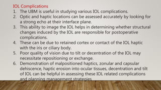 IOL Complications
1. The UBM is useful in studying various IOL complications.
2. Optic and haptic locations can be assessed accurately by looking for
a strong echo at their interface plane.
3. This ability to image the IOL helps in determining whether structural
changes induced by the IOL are responsible for postoperative
complications.
4. These can be due to retained cortex or contact of the IOL haptic
with the iris or ciliary body.
5. Poor quality of vision due to tilt or decentration of the IOL may
necessitate repositioning or exchange.
6. Demonstration of malpositioned haptics, zonular and capsular
dehiscence, haptic erosion into ocular tissues, decentration and tilt
of IOL can be helpful in assessing these IOL related complications
and planning management strategies
 