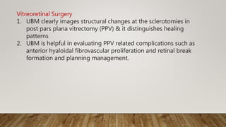 Vitreoretinal Surgery
1. UBM clearly images structural changes at the sclerotomies in
post pars plana vitrectomy (PPV) & it distinguishes healing
patterns
2. UBM is helpful in evaluating PPV related complications such as
anterior hyaloidal fibrovascular proliferation and retinal break
formation and planning management.
 
