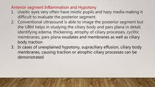 Anterior segment Inﬂammation and Hypotony
1. Uveitic eyes very often have miotic pupils and hazy media making it
difficult to evaluate the posterior segment.
2. Conventional ultrasound is able to image the posterior segment but
the UBM helps in studying the ciliary body and pars plana in detail,
identifying edema, thickening, atrophy of ciliary processes, cyclitic
membranes, pars plana exudates and membranes as well as ciliary
body traction
3. In cases of unexplained hypotony, supraciliary effusion, ciliary body
membranes, causing traction or atrophic ciliary processes can be
demonstrated
 