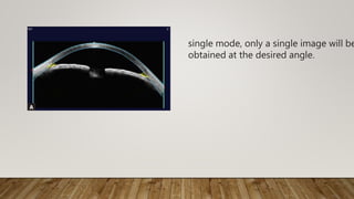 single mode, only a single image will be
obtained at the desired angle.
 