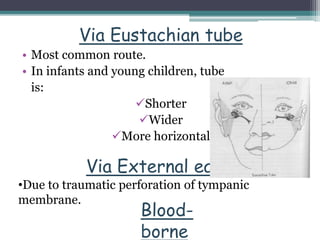 Via Eustachian tube 
• Most common route. 
• In infants and young children, tube 
is: 
Shorter 
Wider 
More horizontal 
Via External ear 
•Due to traumatic perforation of tympanic 
membrane. 
Blood-borne 
 