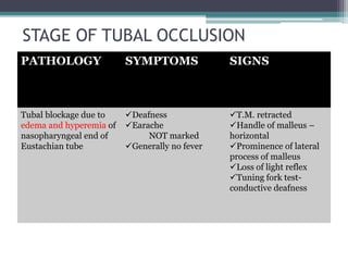 STAGE OF TUBAL OCCLUSION 
PATHOLOGY SYMPTOMS SIGNS 
Tubal blockage due to 
edema and hyperemia of 
nasopharyngeal end of 
Eustachian tube 
Deafness 
Earache 
NOT marked 
Generally no fever 
T.M. retracted 
Handle of malleus – 
horizontal 
Prominence of lateral 
process of malleus 
Loss of light reflex 
Tuning fork test-conductive 
deafness 
 