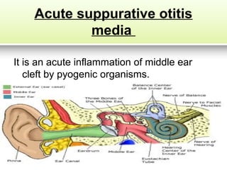 Asom | PPT