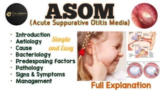 ASOM (Acute Suppurative Otitis Media..).pptx