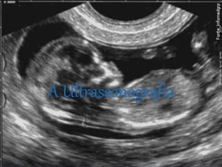 A Ultrassonografia 
 