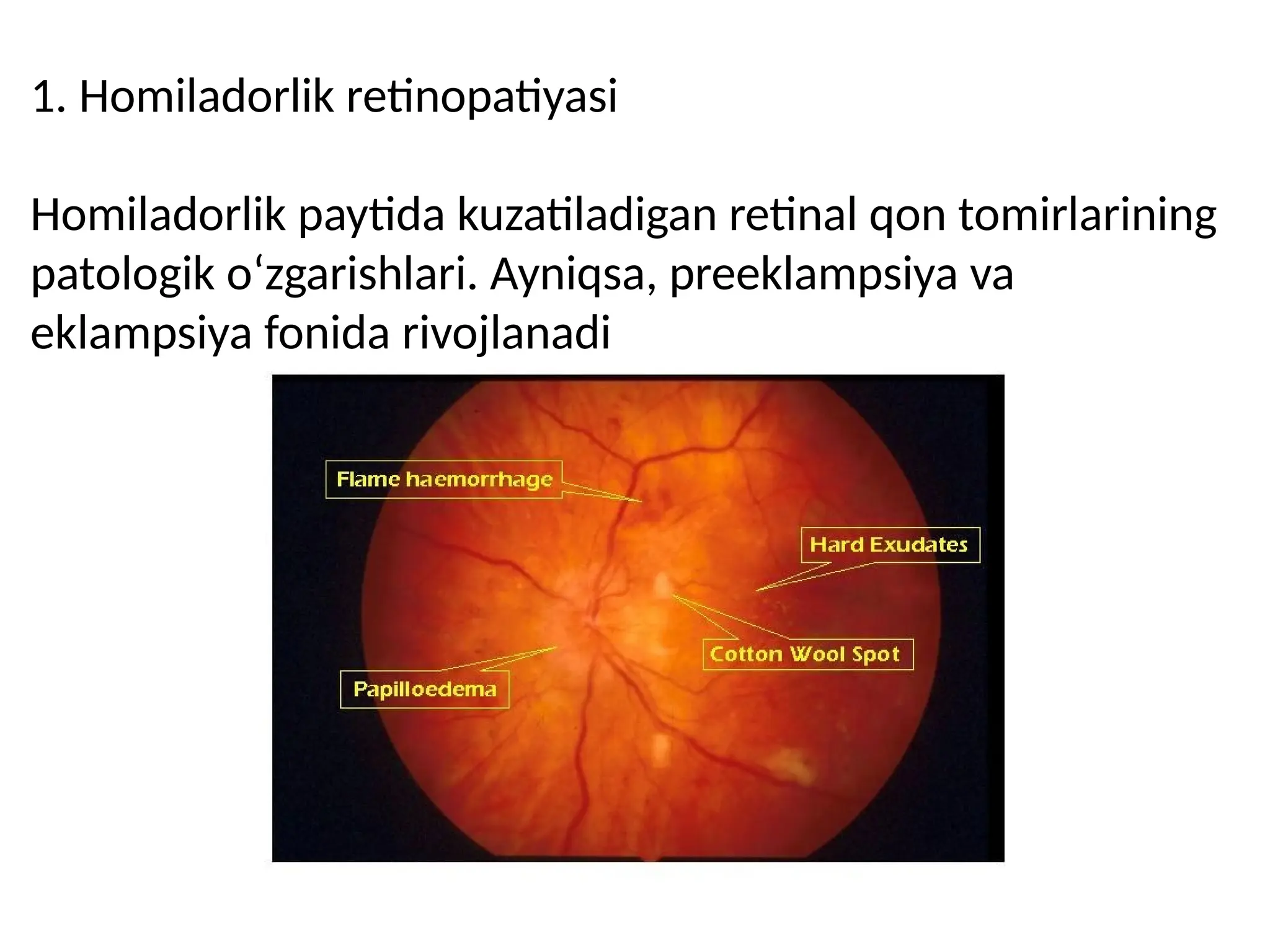 Mashhur blowjob video Omegle jinsiy aloqa tasmasi