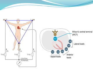 ASP ECG. Ecg basics for mbbs dnetal vertinary students | PPTX