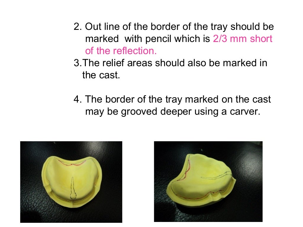 A special tray is defined final
