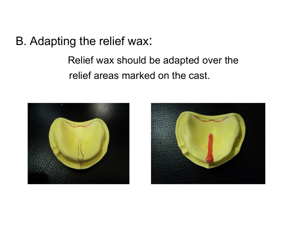 A special tray is defined final