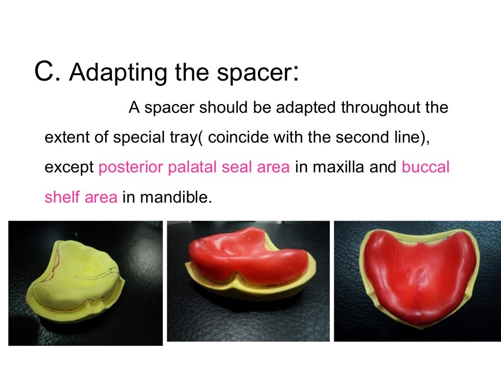 A special tray is defined final