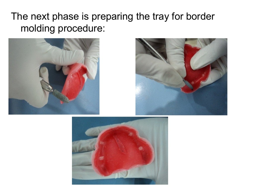 A special tray is defined final