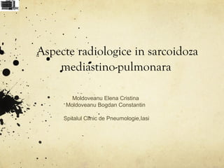 Aspecte radiologice in sarcoidoza
mediastino-pulmonara
Moldoveanu Elena Cristina
Moldoveanu Bogdan Constantin
Spitalul Clinic de Pneumologie,Iasi
 