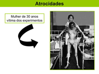 Atrocidades
Mulher de 30 anos
vítima dos experimentos
 