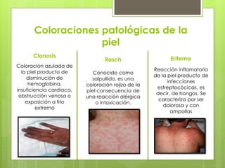 Coloraciones patológicas de la 
piel 
Coloración azulada de 
la piel producto de 
disminución de 
hemoglobina, 
insuficiencia cardiaca, 
obstrucción venosa o 
exposición a frio 
extremo 
Conocido como 
salpullido, es una 
coloración rojizo de la 
piel consecuencia de 
una reacción alérgica 
o intoxicación. 
Cianosis 
Rasch Eritema 
Reacción inflamatoria 
de la piel producto de 
infecciones 
estreptocócicas, es 
decir, de hongos. Se 
caracteriza por ser 
dolorosa y con 
ampollas 
 