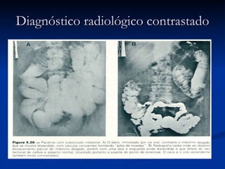 Diagnóstico radiológico contrastado 