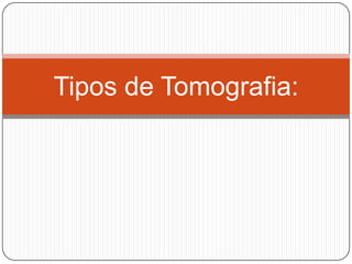 Tipos de Tomografia: