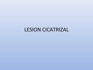 LESION CICATRIZAL 
 