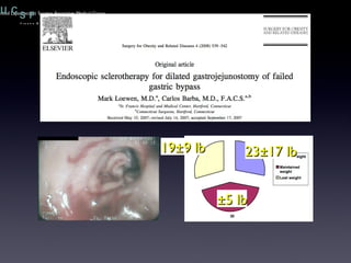 19±9 lb 23±17 lb ±5 lb 
