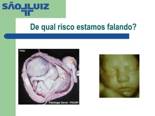 De qual risco estamos falando? 