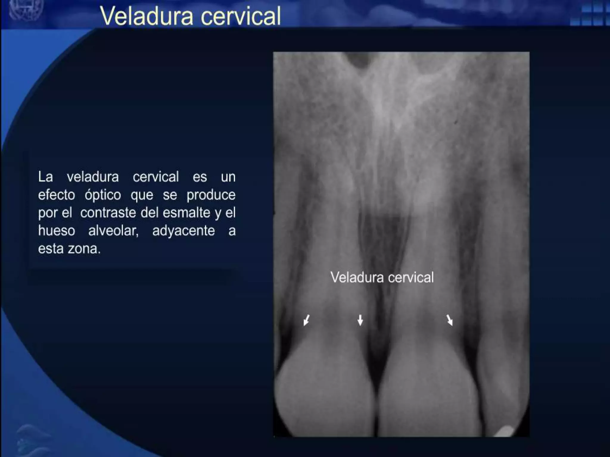 Aspectos radiografico normal (1) | PPT | Free Download