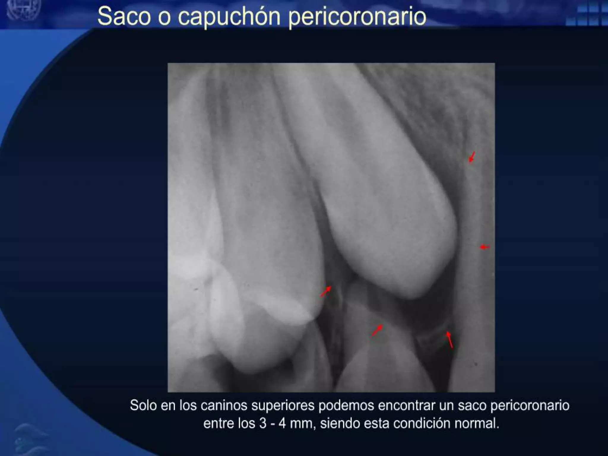 Aspectos radiografico normal (1) | PPT