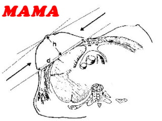 MAMA
 