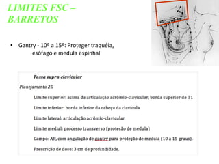 • Gantry - 10º a 15º: Proteger traquéia,
esôfago e medula espinhal
LIMITES FSC –
BARRETOS
 