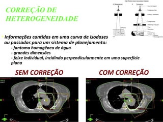 • Informações contidas em uma curva de isodoses
ou passadas para um sistema de planejamento:
- fantoma homogêneo de água
- grandes dimensões
- feixe individual, incidindo perpendicularmente em uma superfície
plana
CORREÇÃO DE
HETEROGENEIDADE
SEM CORREÇÃO COM CORREÇÃO
 