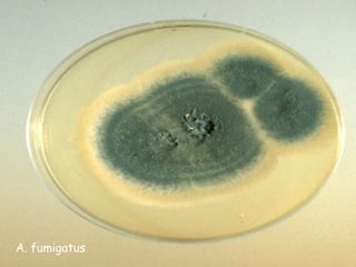 A. fumigatus
 
