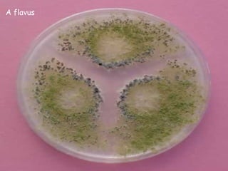 A flavus
 