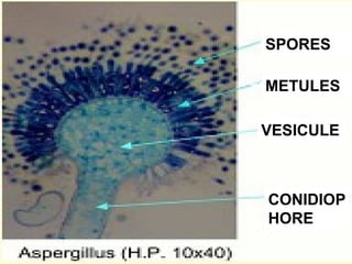 SPORES

METULES

VESICULE



CONIDIOP
HORE
 