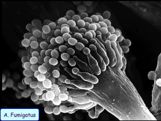 A. Fumigatus
 