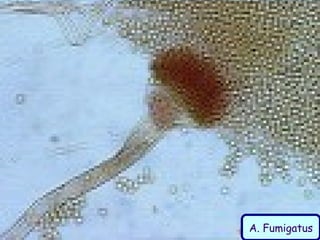 A. Fumigatus
 